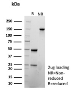 SDS-PAGE Analysis of Purified SLAMF7 / CD319 Mouse Monoclonal Antibody (SLAMF7/13123). Confirmation of Purity and Integrity of Antibody.