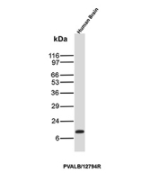 Western blot analysis of Calcium-Binding Protein PV/PVALB antibody (clone PVALB/12794R) in human brain tissue lysate. A distinct immunoreactive band is observed at approximately 12 kDa, consistent with the predicted molecular weight of Parvalbumin based on its amino acid sequence. The band migrates in the expected low molecular weight range for this small cytosolic EF-hand calcium-binding protein. The signal intensity supports detection of Parvalbumin in human brain tissue under the conditions tested.