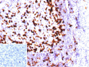 Immunohistochemistry analysis of Calcium-Binding Protein PV/PVALB antibody (clone PVALB/12794R) in human tonsil tissue. FFPE human tonsil demonstrates cytoplasmic HRP-DAB brown staining in scattered cells within the lymphoid tissue, consistent with Parvalbumin expression. Positive cells are distributed throughout the tissue and exhibit granular cytoplasmic staining, while surrounding lymphocytes show minimal to no specific signal. The inset represents a secondary antibody negative control in which PBS was used in place of the primary antibody and shows absence of specific staining. Heat induced epitope retrieval was performed by heating tissue sections in 10 mM Tris with 1 mM EDTA, pH 9.0, at 95oC for 45 minutes followed by cooling at room temperature for 20 minutes prior to immunostaining.