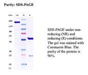 SDS-PAGE Analysis of Purified Nonsense-Mediated mRNA Decay Protein/UPF1 antibody (clone NY1.1.1B6). Confirmation of Purity and Integrity of Antibody.