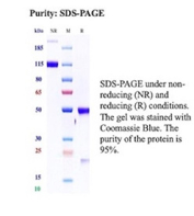 SDS-PAGE Analysis of Purified Alpha-SMA/Myofibroblast Marker antibody (ACTA2/13673R). Confirmation of Purity and Integrity of Antibody.