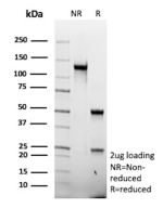 SDS-PAGE Analysis of Purified SELE / CD62E antibody (clone r16G4). Confirmation of Purity and Integrity of Antibody.