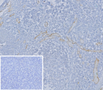 Immunohistochemistry analysis of SELE/E-selectin antibody in human tonsil tissue. FFPE human tonsil sections show HRP-DAB brown staining localized to endothelial cells lining small vessels within the interfollicular regions, consistent with E-selectin, also known as CD62E, expression in activated vascular endothelium. Lymphoid cells within germinal centers are largely negative. The inset negative control, in which PBS was used in place of primary antibody, shows no specific brown chromogenic signal. Heat induced epitope retrieval was performed in 10 mM Tris with 1 mM EDTA, pH 9.0, by heating at 95oC for 45 minutes followed by cooling at room temperature for 20 minutes.