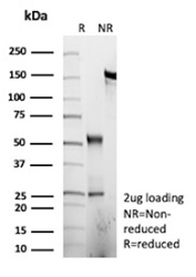 SDS-PAGE Analysis of Purified PRPH/Peripherin antibody (r19H7). Confirmation of Purity and Integrity of Antibody.