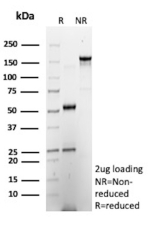 SDS-PAGE Analysis of Purified CXCR5 Mouse Monoclonal Antibody (CXCR5/13100). Confirmation of Purity and Integrity of Antibody.