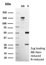 SDS-PAGE Analysis of Purified CXCR5 Mouse Monoclonal Antibody (CXCR5/13095). Confirmation of Purity and Integrity of Antibody.