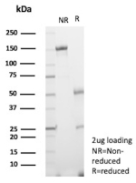SDS-PAGE Analysis of Purified CXCR5 Mouse Monoclonal Antibody (CXCR5/13096). Confirmation of Purity and Integrity of Antibody.