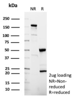 SDS-PAGE Analysis of Purified CXCR5 Mouse Monoclonal Antibody (CXCR5/13098). Confirmation of Purity and Integrity of Antibody.