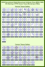 Transcription factor SOX-9 Rabbit Recombinant Monoclonal Antibody (MSVA-709R) tested on many normal and cancer tissues. The immunohistochemistry staining in these tissues aligns with the expression data in Human Protein Atlas. <br><br>Manual Protocol: Freshly cut sections should be used (less than 10 days between cutting and staining). Heat-induced antigen retrieval for 5 minutes in an autoclave at 121oC in pH 7.8 Target Retrieval Solution buffer. Apply the antibody at a dilution of 1:150 at 37oC for 60 minutes. Visualization of bound antibody by the EnVision Kit (Dako, Agilent) according to the manufacturer's directions.