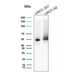 Western Blot Analysis of UACC-257 and UACC-62 cell lysates using SOX10 Recombinant Mouse Monoclonal Antibody (rSOX10/13506).
