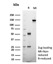 SDS-PAGE Analysis of Purified SRY-box transcription factor 10/SOX10 antibody (rSOX10/13506). Confirmation of Purity and Integrity of Antibody.