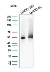 Western blot analysis of SOX10 antibody (clone rSOX10/991). UACC-257 and UACC-62 whole cell lysates were resolved by SDS-PAGE and immunoblotted with Transcription factor SOX10 antibody. A distinct band is observed at approximately 50-55 kDa in both lysates, consistent with the predicted molecular weight of SOX10.