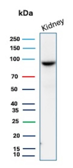 Western blot analysis of human kidney tissue lysate using STAT6 Rabbit Recombinant Monoclonal Antibody (STAT6/12798R).