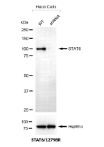 Western Blot validation of anti-STAT6 antibody. STAT6 protein expression was compared in wild-type (WT) and STAT6 shRNA Knockdown (KD) HeLa cells (30ug of total protein). Loading control is shown below.