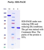Immunohistochemistry analysis of BST2/Bone marrow stromal antigen 2 antibody in human ovary tissue (clone BST2/13681R). FFPE human ovary sections demonstrate HRP-DAB brown membranous and cytoplasmic staining in epithelial cells lining ovarian structures, with strong cell surface localization consistent with Bone marrow stromal antigen 2 expression. Surrounding stromal areas show comparatively weaker staining. The inset shows PBS used in place of primary antibody as a secondary antibody negative control, demonstrating absence of specific brown staining. Heat induced epitope retrieval was performed by boiling tissue sections in pH 9 10 mM Tris with 1 mM EDTA for 20 minutes followed by cooling prior to antibody incubation.