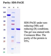 SDS-PAGE Analysis of Purified CD317/BST2 antibody (BST2/13682R). Confirmation of Purity and Integrity of Antibody.