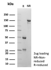 SDS-PAGE Analysis of Purified Hepatocyte nuclear factor 1 beta/HNF1B antibody (HNF1B/9519). Confirmation of Purity and Integrity of Antibody.