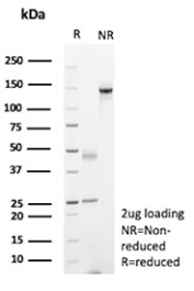 SDS-PAGE Analysis of Purified TCF2/HNF1B antibody (HNF1B/9519). Confirmation of Purity and Integrity of Antibody.