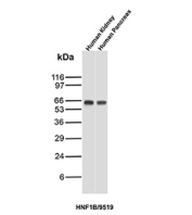 Western blot analysis of TCF2/HNF1B antibody in human kidney and human pancreas tissue lysates (clone HNF1B/9519). A distinct immunoreactive band is observed at approximately 60-65 kDa in both human kidney and human pancreas samples, consistent with the predicted molecular weight of Hepatocyte nuclear factor 1 beta. Band intensity is comparable between tissues, reflecting known epithelial expression in renal tubular and pancreatic ductal cells. No significant non-specific bands are detected under the conditions tested. Molecular weight markers are shown at left.