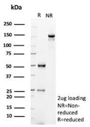 SDS-PAGE Analysis of CD202b/TIE2 antibody (TEK/9411). Confirmation of Purity and Integrity of Antibody.
