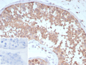 Immunohistochemistry analysis of CD202b / TIE2 antibody in human testis tissue (clone TEK/9411). FFPE human testis sections demonstrate HRP-DAB brown cytoplasmic and membranous staining in cells within seminiferous tubules, consistent with TEK receptor tyrosine kinase expression in vascular and interstitial compartments. Endothelial cells associated with microvasculature show distinct membranous brown chromogenic signal, while surrounding stromal elements display minimal staining. The inset shows PBS used in place of primary antibody as a secondary antibody negative control, confirming absence of specific brown signal. Heat induced epitope retrieval was performed in 10 mM Tris with 1 mM EDTA, pH 9.0, by heating tissue sections at 95oC for 45 minutes followed by cooling at room temperature for 20 minutes prior to antibody incubation.