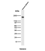 Western blot analysis of Angiopoietin Receptor / TIE2 antibody in human spleen lysate (clone TEK/9412). A distinct immunoreactive band is detected at approximately 140-145 kDa, consistent with the predicted molecular weight of TEK receptor tyrosine kinase. The band appears as a single prominent species without significant non-specific background under the conditions tested. TEK is known to undergo glycosylation, which may contribute to slight migration variability on SDS-PAGE. Molecular weight markers are shown at left.
