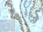 Formalin-fixed, paraffin-embedded human tonsil stained with p53 Recombinant Mouse Monoclonal Antibody (rIMX25). Inset: PBS instead of primary antibody; secondary only negative control.