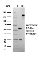 SDS-PAGE Analysis of Purified UBB/Ubiquitin antibody (rFPM1). Confirmation of Purity and Integrity of Antibody.