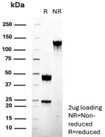 SDS-PAGE Analysis of Purified Complement Component C9 Recombinant Mouse Monoclonal Antibody (r10A6). Confirmation of Purity and Integrity of Antibody.