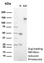 SDS-PAGE Analysis of Purified Thyroid Transcription Factor PAX8 antibody (clone PAX8/12570). Confirmation of Purity and Integrity of Antibody.