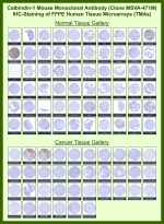 Immunohistochemistry analysis of Calbindin-D28k/CALB1 antibody (clone MSVA-471M) in human tissue microarrays. Formalin-fixed, paraffin-embedded normal and cancer tissues demonstrate strong cytoplasmic HRP-DAB brown staining in cerebellar Purkinje cells and select renal tubular epithelial cells, while most other normal tissues show low or absent staining. In cancer specimens, the majority of tumor types display negative or weak staining, consistent with restricted physiologic expression patterns. The observed staining distribution aligns with publicly available expression data, supporting selective detection of CALB1 in tissues known to express Calbindin.
