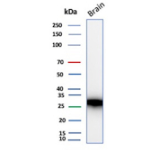 Western blot analysis of D28K / CALB1 antibody (clone rCALB1/9805) in human brain tissue lysate. A single prominent band is detected at approximately 28 kDa, corresponding to the predicted molecular weight of Calbindin-D28k. The observed band supports specific detection of endogenous CALB1 protein in human brain under reducing conditions.