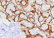 Immunohistochemistry analysis of Placental Protein 5 / TFPI2 antibody (clone TFPI2/13028) in human placental tissue. Formalin-fixed, paraffin-embedded placenta demonstrates prominent extracellular and pericellular HRP-DAB brown staining outlining chorionic villi and trophoblastic structures, consistent with matrix-associated TFPI2 expression. Nuclear counterstain highlights cellular morphology. The inset shows PBS used in place of primary antibody as a negative control, confirming absence of specific staining. Heat-induced epitope retrieval was performed by heating tissue sections in 10 mM Tris with 1 mM EDTA, pH 9.0, for 45 minutes at 95oC followed by cooling at room temperature for 20 minutes prior to staining.