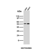 Western blot analysis of Nectin cell adhesion molecule 4 / NECTIN4 antibody (clone NECTIN4/9906) in human A-431 and MCF7 cell lysates. A distinct band is detected at approximately 60-70 kDa in both lanes, consistent with the predicted molecular weight of Nectin-4, a glycosylated type I transmembrane protein. The observed migration slightly above the core predicted size is consistent with known N-linked glycosylation of NECTIN4. Band intensity is comparable between A-431 and MCF7 cells, supporting expression in epithelial-derived tumor cell lines.