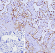 Immunohistochemistry analysis of Nectin cell adhesion molecule 4 / NECTIN4 antibody (clone NECTIN4/9906) in human placental tissue. Formalin-fixed, paraffin-embedded placenta demonstrates membranous HRP-DAB brown staining outlining trophoblastic cells within chorionic villi, consistent with surface localization of Nectin-4. The staining pattern highlights cell-cell borders with minimal background in stromal regions. Hematoxylin counterstain delineates nuclear morphology and villous architecture. The inset shows PBS used in place of primary antibody as a negative control, confirming absence of non-specific secondary antibody binding. Heat-induced epitope retrieval was performed by heating tissue sections in 10 mM Tris with 1 mM EDTA, pH 9.0, for 45 minutes at 95oC followed by cooling at room temperature for 20 minutes prior to staining.
