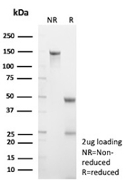 SDS-PAGE Analysis of Purified Nectin cell adhesion molecule 4/NECTIN4 antibody (NECTIN4/9906). Confirmation of Purity and Integrity of Antibody.