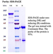 SDS-PAGE Analysis of Purified Poliovirus receptor related 4/NECTIN4 antibody (NECTIN4/13438R). Confirmation of Purity and Integrity of Antibody.