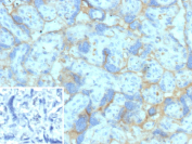 Immunohistochemistry analysis of Poliovirus receptor related 4 / NECTIN4 antibody (clone NECTIN4/13438R) in human placental tissue. Formalin-fixed, paraffin-embedded placenta demonstrates membranous HRP-DAB brown staining outlining trophoblastic cells and chorionic villi, consistent with cell surface localization of Nectin-4. Background staining is minimal, and hematoxylin counterstain highlights tissue morphology. The inset shows PBS used in place of primary antibody as a negative control, confirming absence of non-specific secondary antibody binding. Heat-induced epitope retrieval was performed by heating tissue sections in 10 mM Tris with 1 mM EDTA, pH 9.0, for 45 minutes at 95oC followed by cooling at room temperature for 20 minutes prior to staining.