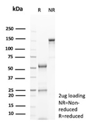 Western Blot Analysis of PANC28 cell lysate using VEGFA Recombinant Mouse Monoclonal Antibody (rDTX1).