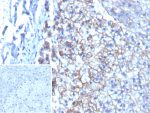 Formalin-fixed, paraffin-embedded human adrenal gland stained with MRP3 Recombinant Mouse Monoclonal Antibody (rDTX1). Inset: PBS instead of primary antibody; secondary only negative control.