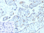 Formalin-fixed, paraffin-embedded human placenta stained with Cyclin E Recombinant Rabbit Mouse Antibody (r13A3). Inset: PBS instead of primary antibody; secondary only negative control.