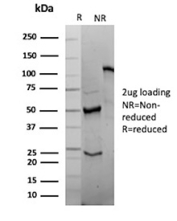 SDS-PAGE Analysis of Purified CD2 molecule antibody (clone LFA2/13325R). Confirmation of Purity and Integrity of Antibody.