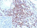Formalin-fixed, paraffin-embedded human tonsil stained with T Cell Receptor delta Recombinant Rabbit Monoclonal Antibody (CD3D/13089R). Inset: PBS instead of primary antibody; secondary only negative control.
