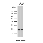 Western Blot analysis of Jurkat and MOLT-4 cell lysates using CD3D Recombinant Rabbit Monoclonal Antibody (CD3D/13089R).