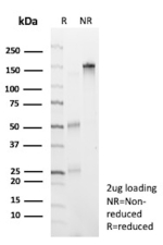 SDS-PAGE Analysis of Purified CD7 molecule antibody (clone CD7/13034R). Confirmation of Purity and Integrity of Antibody.