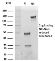 SDS-PAGE Analysis of Purified CD19/CD19 molecule antibody (clone CD19/4260R). Confirmation of Purity and Integrity of Antibody.