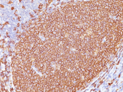Immunohistochemistry analysis of MS4A1 Antibody / Membrane spanning 4-domains A1 in human tonsil tissue. FFPE human tonsil demonstrates strong, uniform membranous HRP-DAB brown staining in B lymphocytes within germinal centers, sharply delineating follicular architecture consistent with CD20/MS4A1 surface expression, while surrounding interfollicular regions show reduced staining. Antigen retrieval was performed by heating tissue sections in 10mM Tris with 1mM EDTA, pH 9.0, at 95oC for 45 minutes followed by cooling at room temperature for 20 minutes prior to incubation with mouse monoclonal antibodies (clones L26 + IGEL/773).