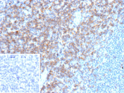 Immunohistochemistry analysis of CD27 Molecule Antibody in FFPE human tonsil tissue. Membranous and cytoplasmic HRP-DAB brown staining is observed in scattered lymphocytes within interfollicular regions and germinal center areas, consistent with CD27 expression on activated and memory B and T lymphocyte populations, while surrounding negative lymphocytes remain unstained. Clone r137B4 demonstrates distinct cell surface localization. The inset shows PBS used in place of the primary antibody as a secondary-only negative control. Heat-induced epitope retrieval was performed in 10mM Tris with 1mM EDTA, pH 9.0, at 95oC for 45 minutes followed by cooling at room temperature for 20 minutes.
