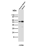 CD27 Antibody for WB. Western blot analysis of CD27 / TNFRSF7 expression in human samples using Cross-Species CD27 Western Blot Antibody clone r137B4. Lane 1: human spleen lysate, Lane 2: Ramos B-cell lysate. A band is detected at approximately 55-60 kDa, consistent with glycosylated CD27, noting a lower predicted molecular weight for the core protein. CD27 is a glycosylated receptor, and this higher apparent molecular weight reflects N-linked glycosylation commonly observed in immune cells. The comparable banding pattern in spleen tissue and Ramos cells supports specific detection of CD27 and consistent performance of clone r137B4 across tissue and cell line samples.