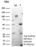 SDS-PAGE Analysis of Purified MUC16 Recombinant Rabbit Monoclonal Antibody (CA125/9923R). Confirmation of Purity and Integrity of Antibody.